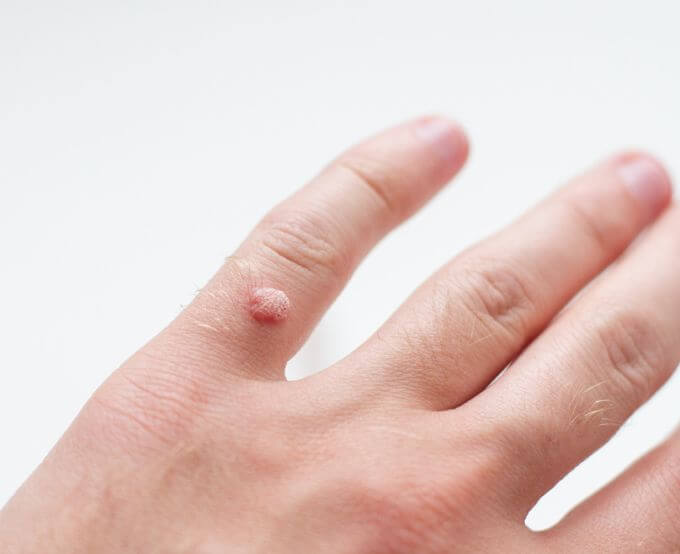 医師の診察を受ける時期